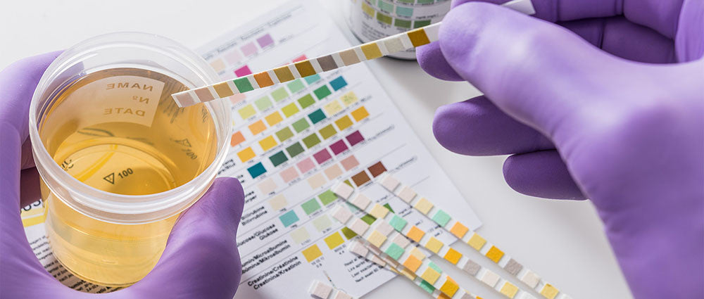 Drug Tests and CBD
